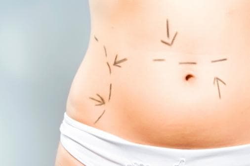 Cosmetic surgery