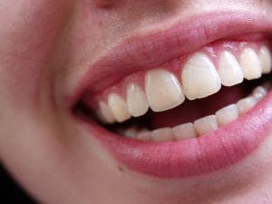 Person teeth